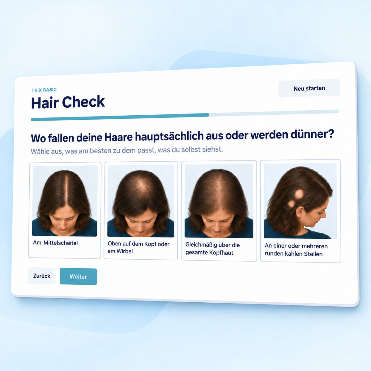 TRIX Basic Hair Check mit visuellen Auswahlmöglichkeiten für verschiedene Haarausfallmuster.